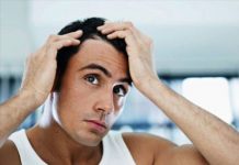 Αλωπεκία Αλωπεκία, πως θεραπεύεται και τι είναι