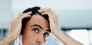 Αλωπεκία, πως θεραπεύεται και τι είναι