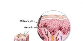 Μελανίνη η κύρια χρωστική ουσία στα μαλλιά. μελανίνη, χρωστική ουσία στα μαλλιά